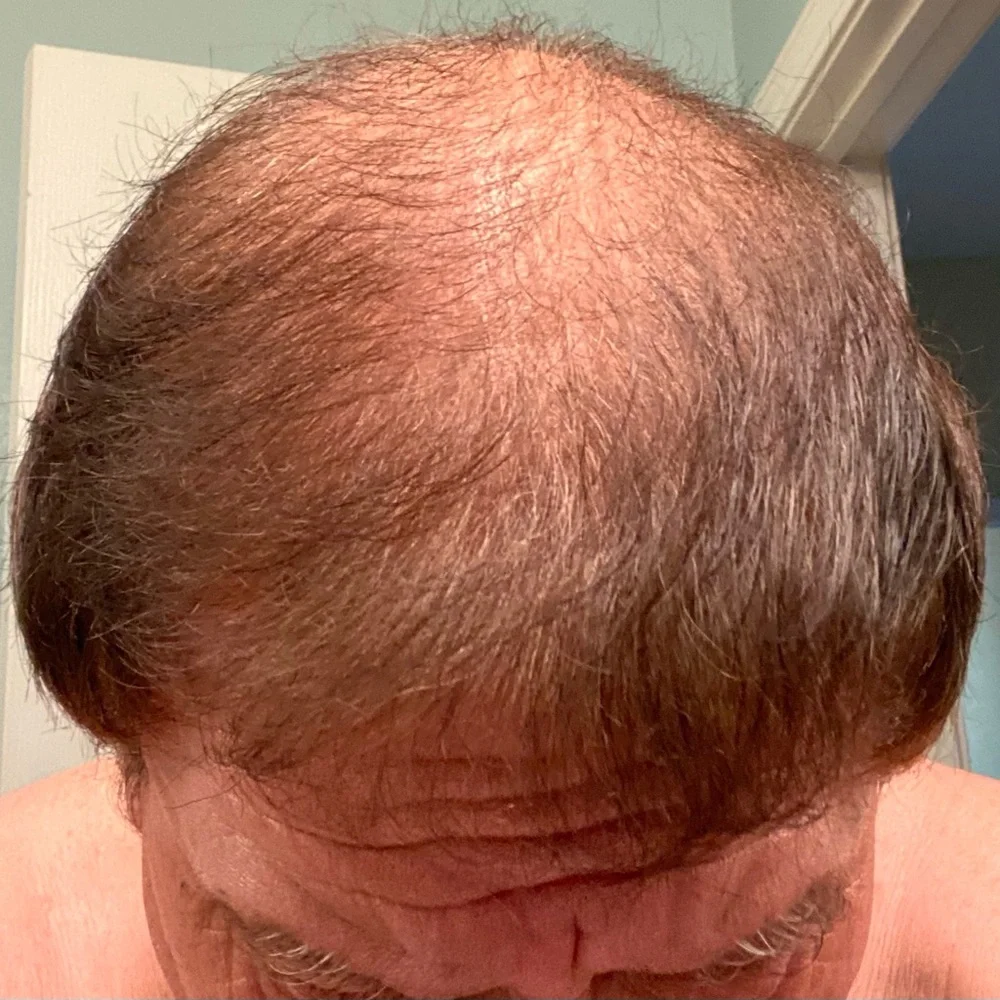 Arzola’s‎ shampoo for hair growth